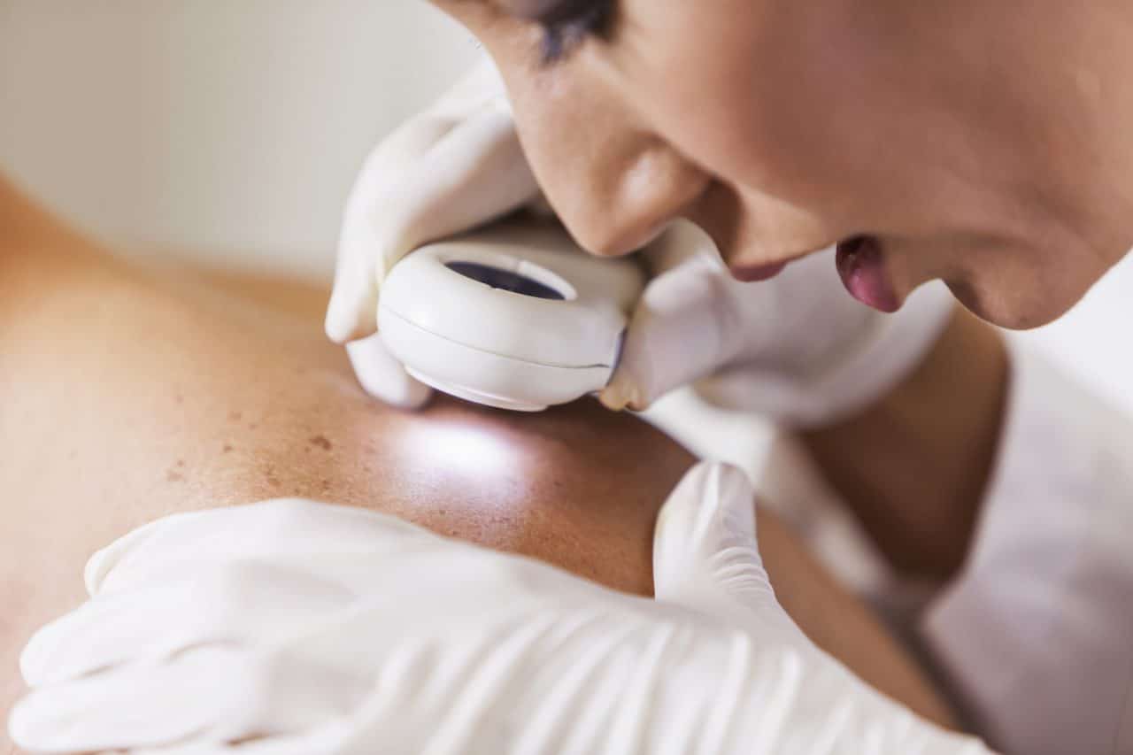 A health care provider examining a patient's spotty skin