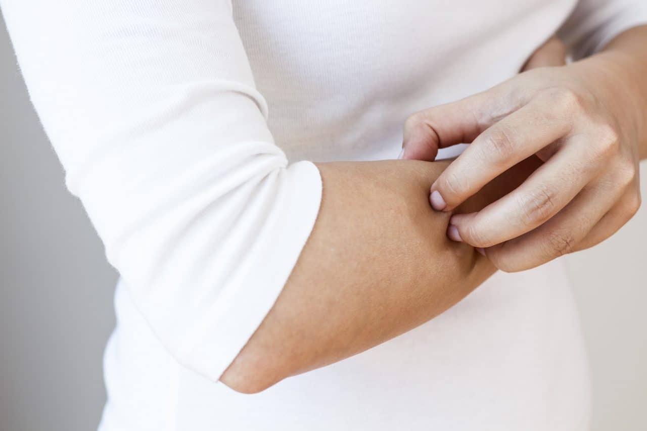 Woman scratching her arm.