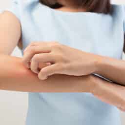 Woman scratching her arm from eczema