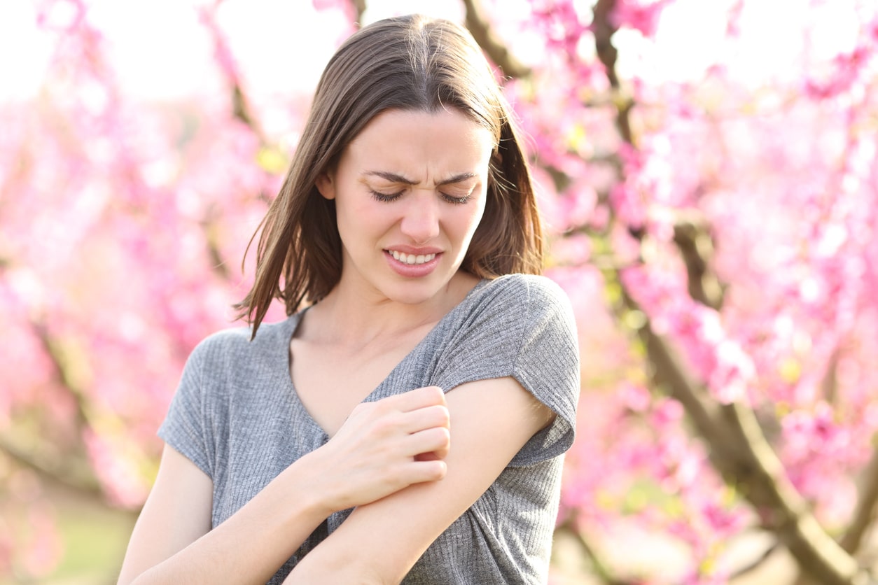 Woman scratches skin outside